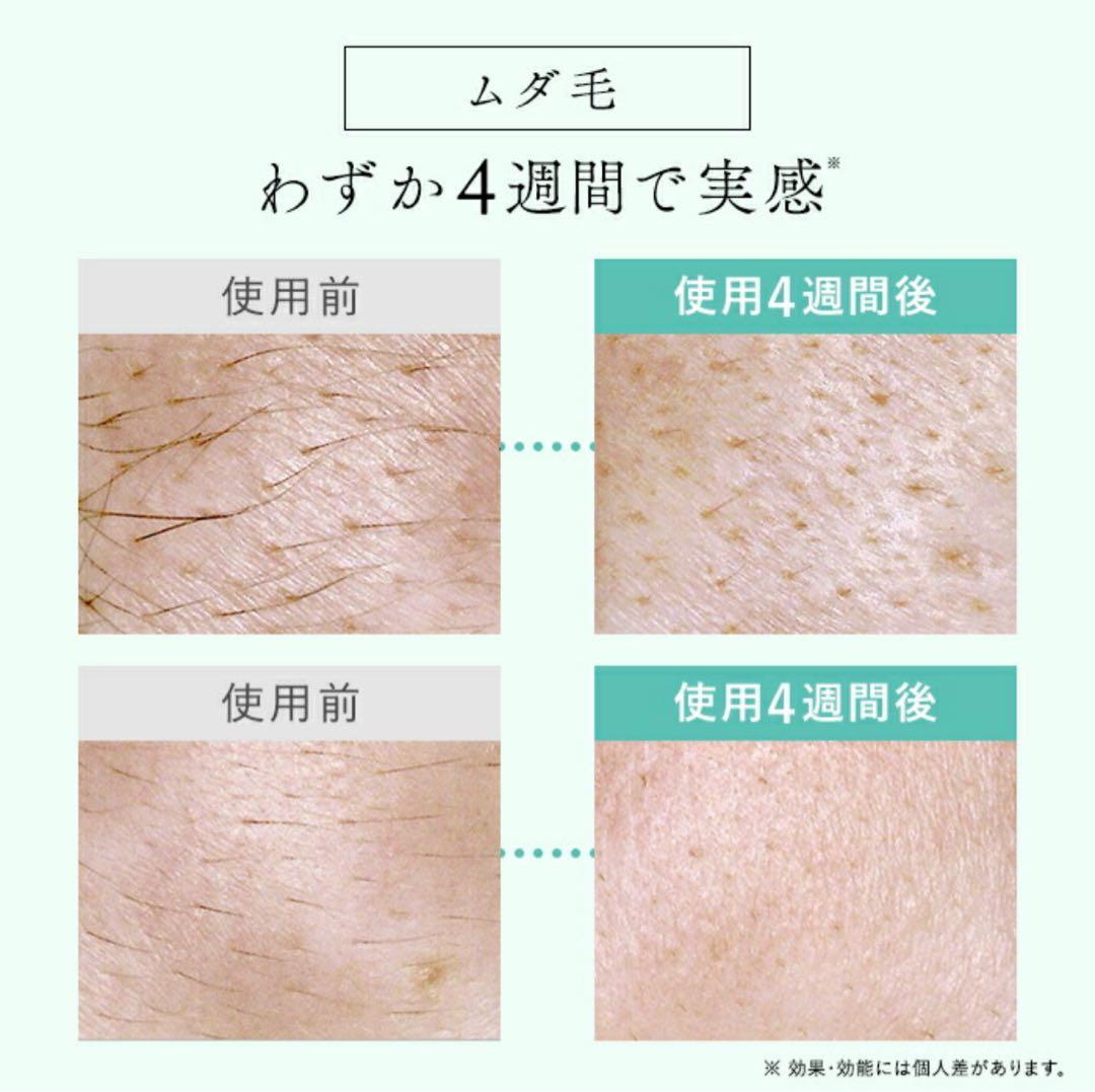 【新品】STELLA BEAUTE ステラボーテ IPL光美容器 光脱毛 美顔器