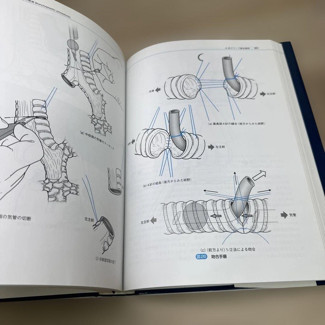 淺村・呼吸器外科手術
