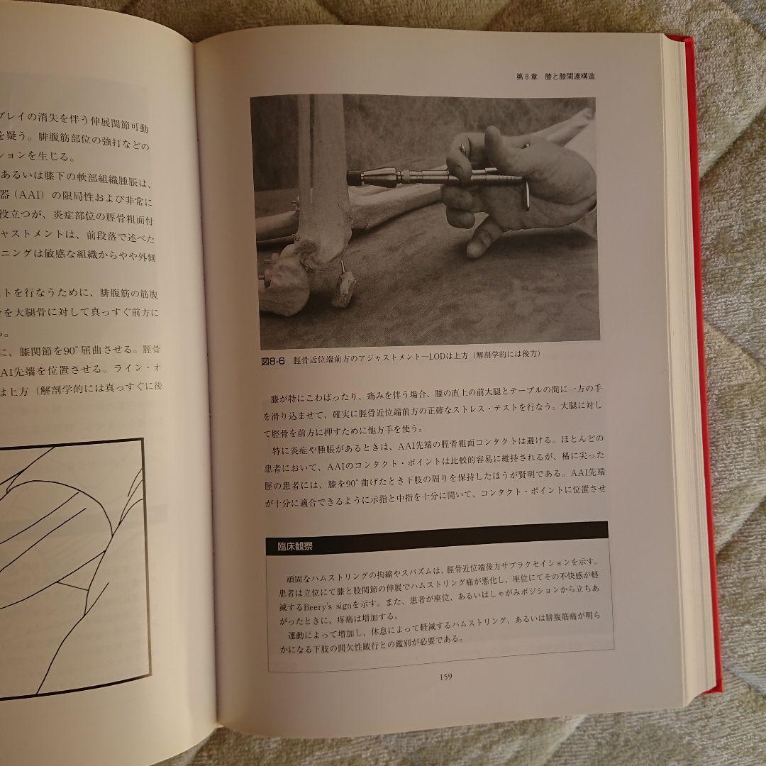 アクティベータ・メソッド カイロプラクティック・テクニック