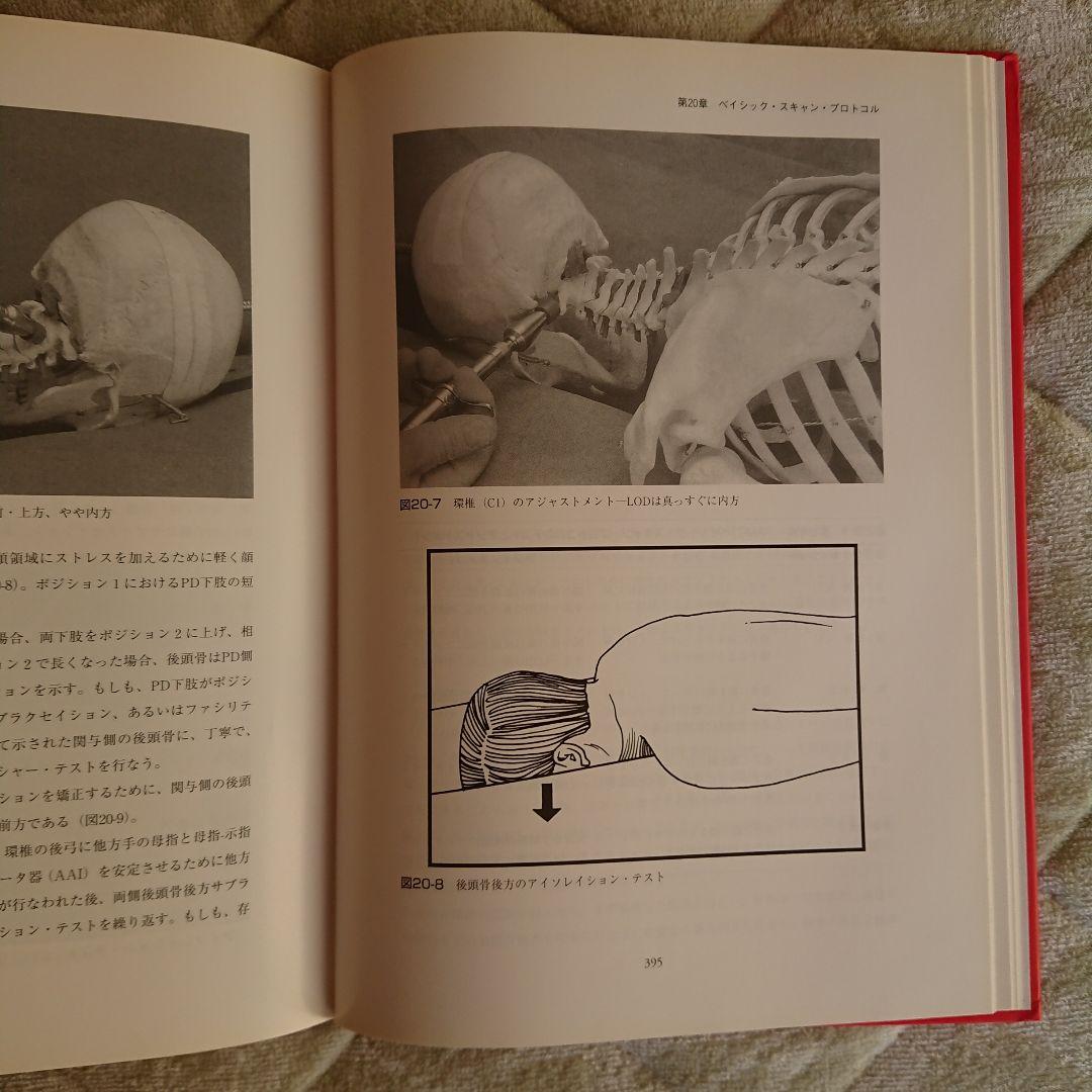 アクティベータ・メソッド カイロプラクティック・テクニック