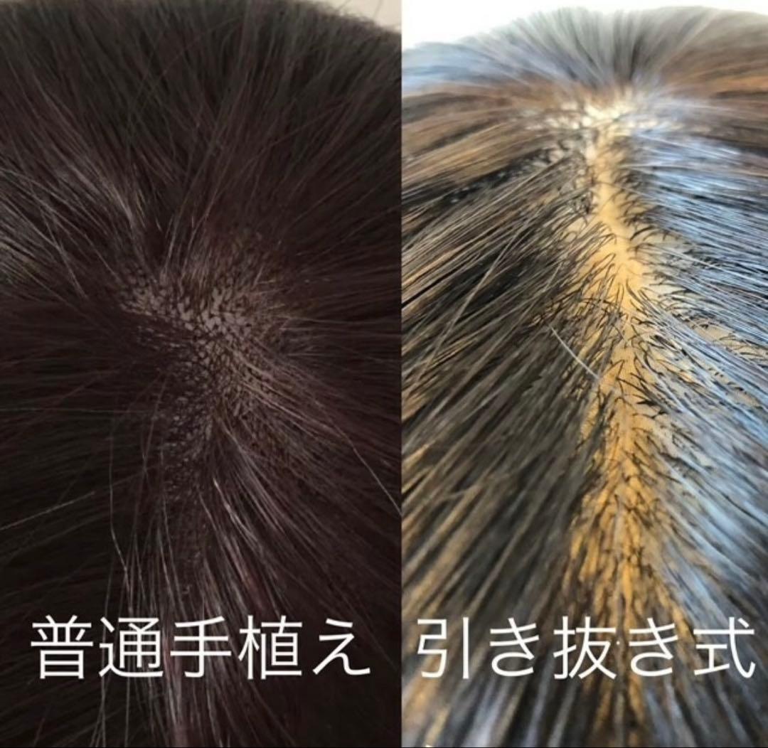 スーパーワイドヘアピース高級人毛100%リアル頭皮二重引き抜き総手植えヘアピース