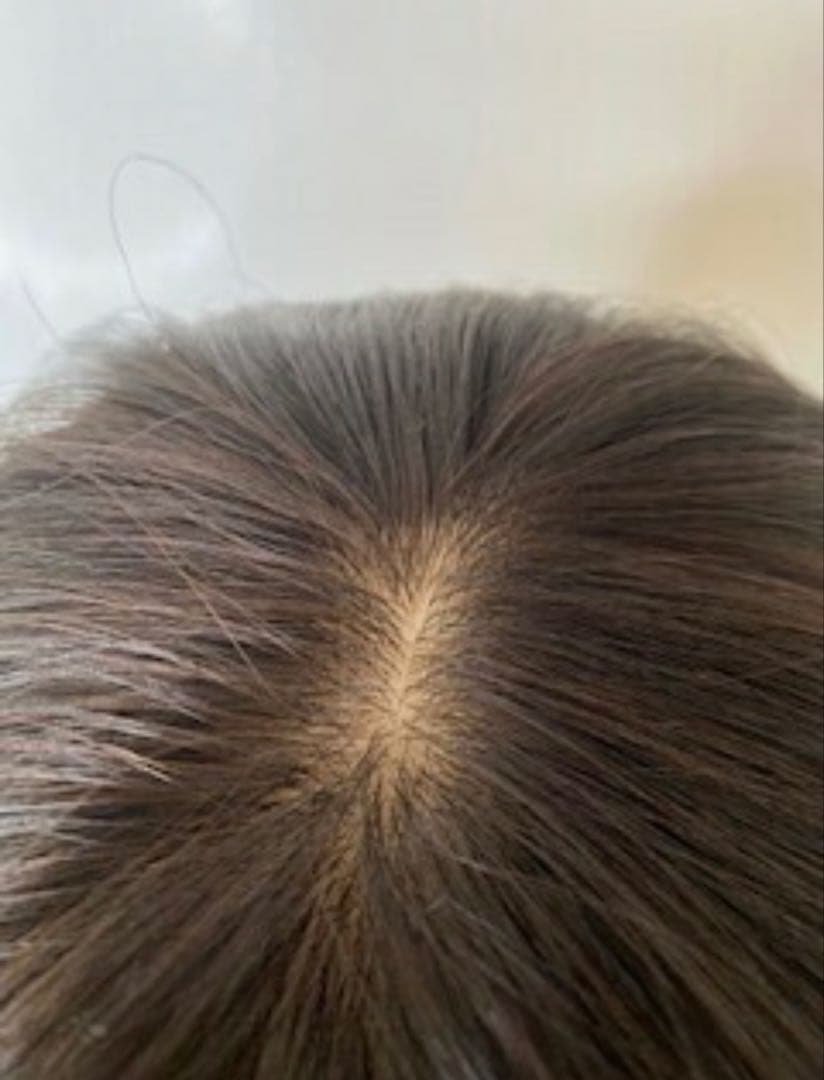 スーパーワイドヘアピース高級人毛100%リアル頭皮二重引き抜き総手植えヘアピース